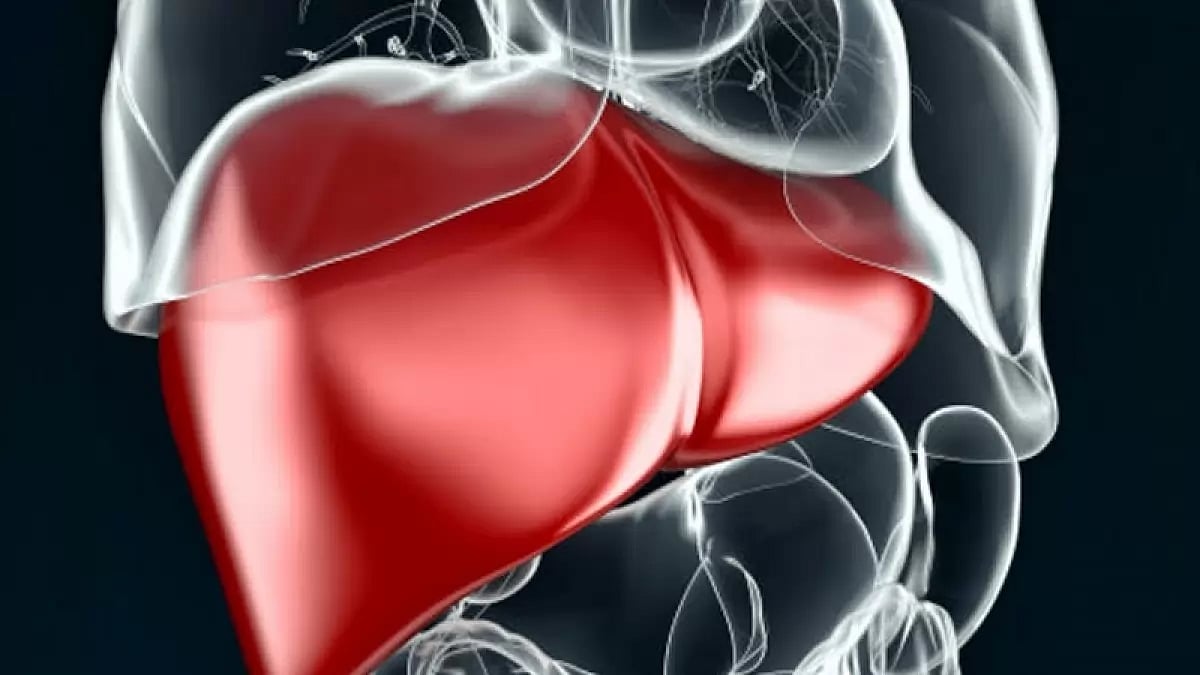 Jaundice spreads to villages of Himachal