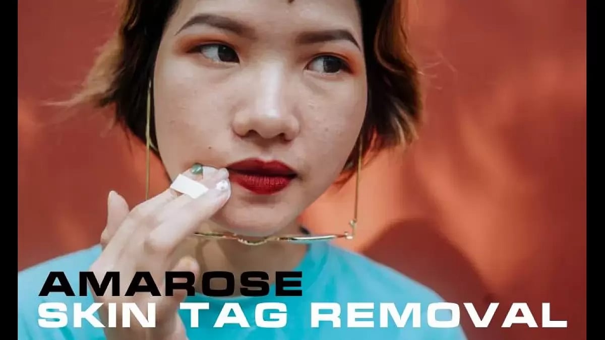 Amarose Skin Tag Remover
