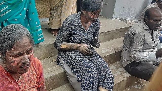 Bengaluru Civic Agency Blaze Injures Nine In Quality Control Division Inferno