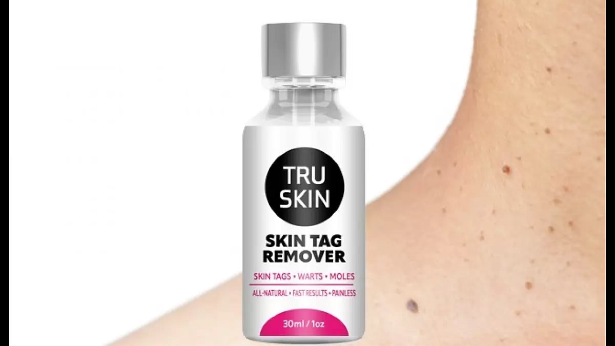 TruSkin Skin Tag Remover