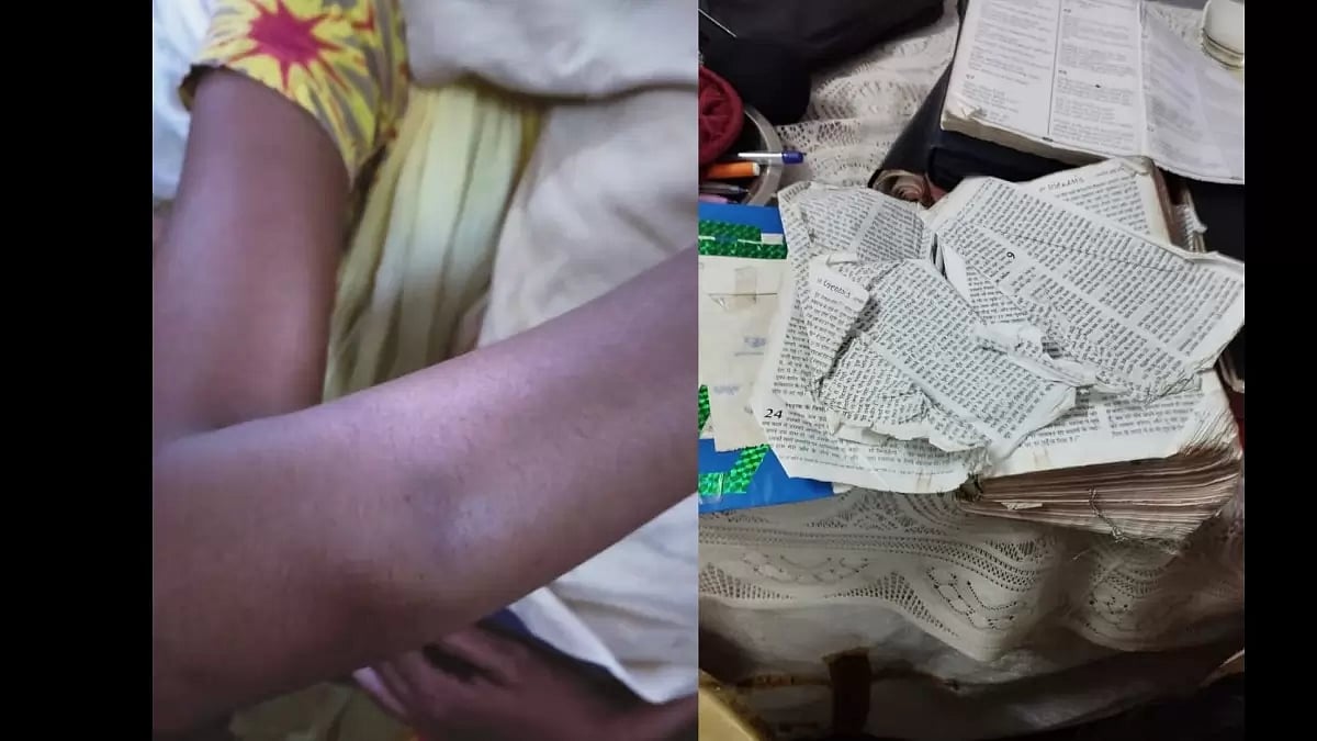 Bruises and torn bible