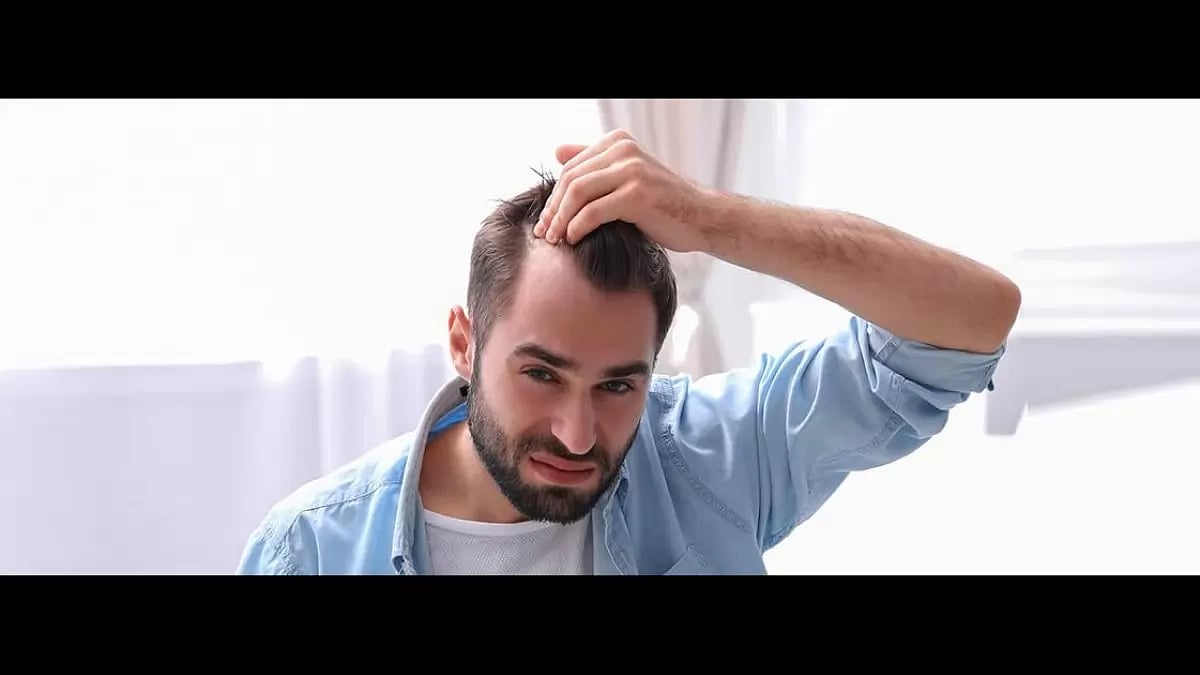 Best Hair Transplant Clinic