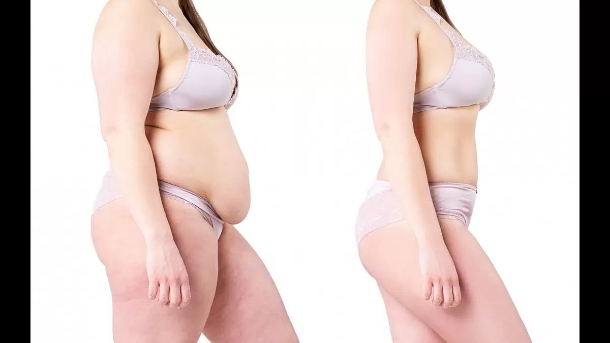 The Ultimate Guide To Mommy Makeovers