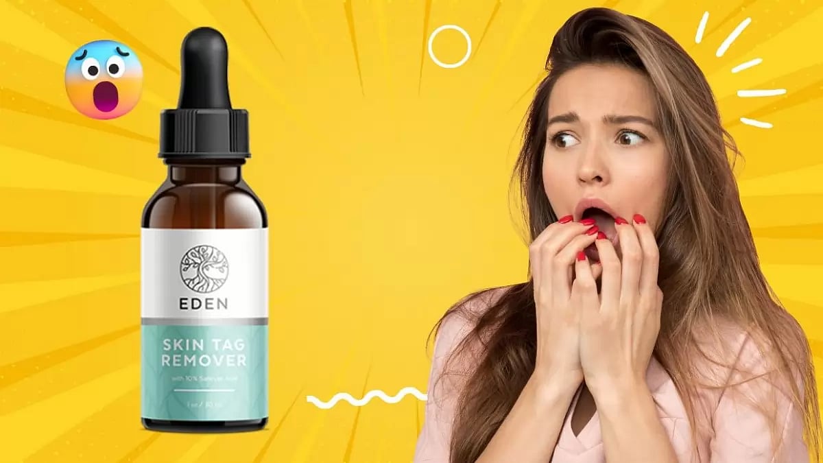 Eden Skin Tag Remover