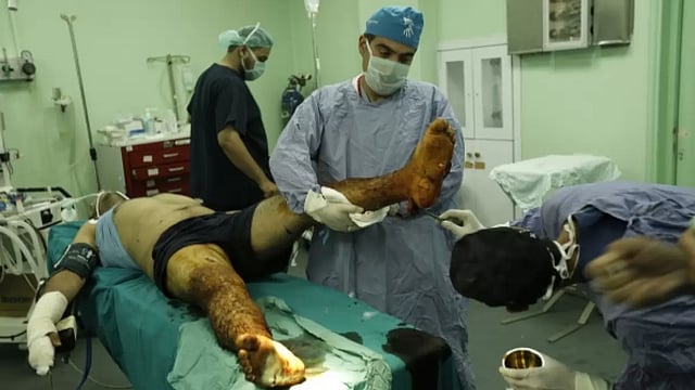 'The Pain Of Operating Without Anesthesia...' A Doctor On Gaza's Health Crisis