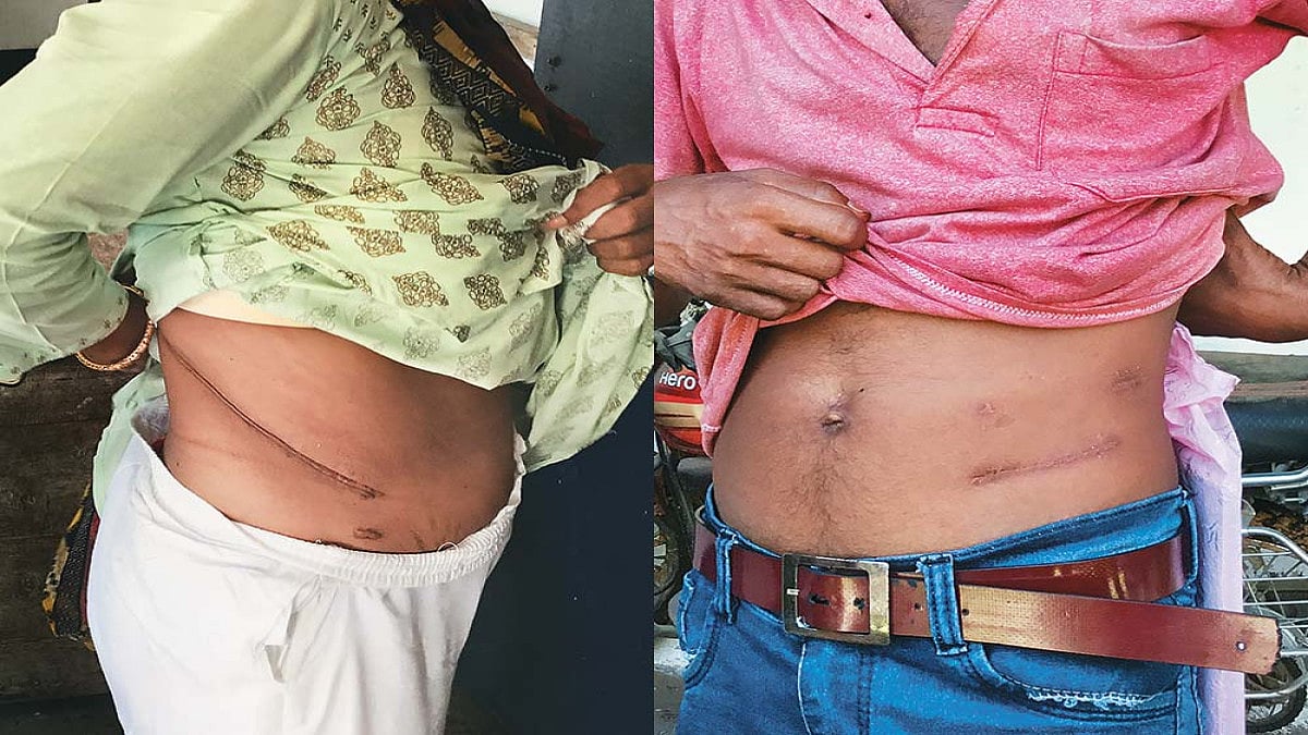 Organ Racket Preys On Financial Woes Of The Poor In Assam