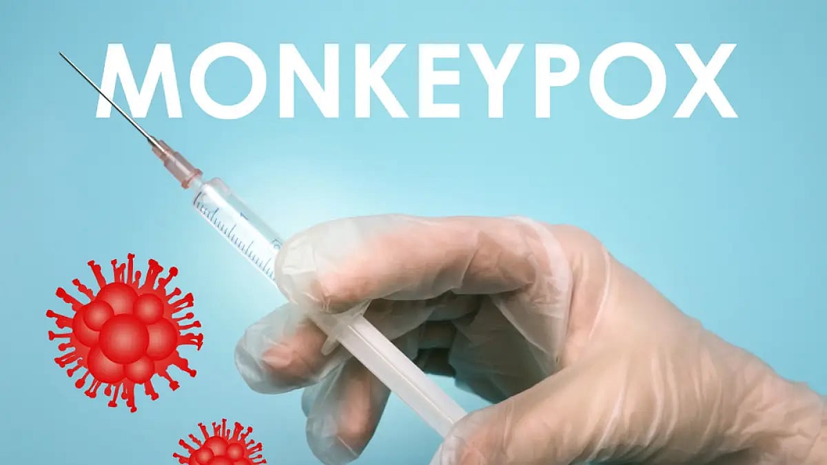 Monkeypox: Health Officials On Alert In Dakshina Kannada District