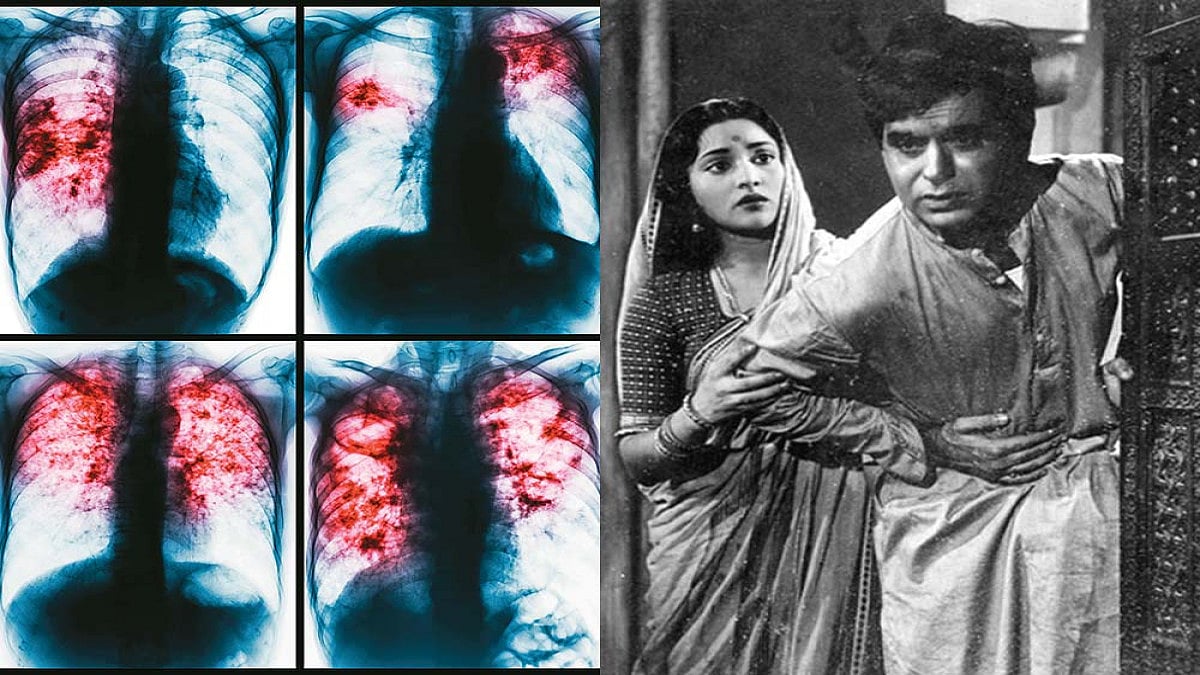 Need Lungs To Choke TB