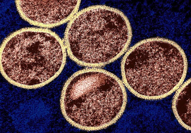 The National Institute of Allergy and Infectious Diseases/Wikimedia Commons