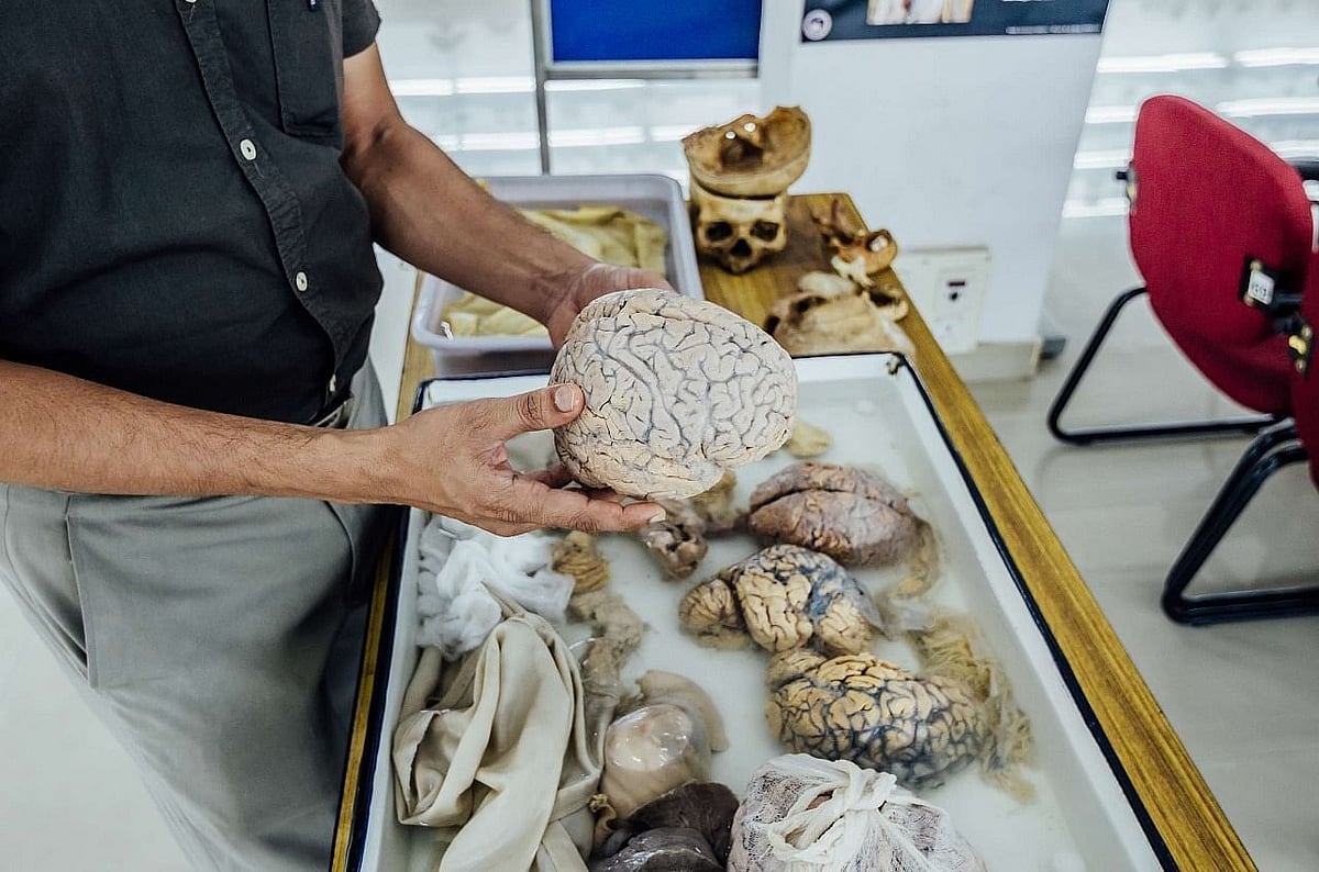 The neuropathology department staff allow visitors to touch and feel the brain on request
