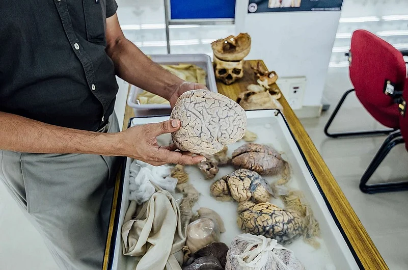 The neuropathology department staff allow visitors to touch and feel the brain on request
