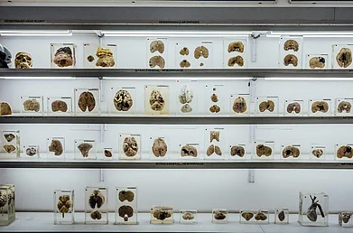museumsofindia.org : The Neuropathology Brain Museum at the National Institute of Mental Health and Neuro Sciences (NIMHANS) has a collection of over 400 brain specimens