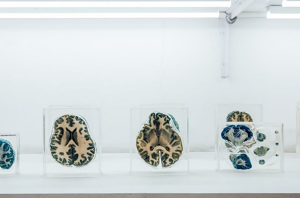 A display of brain specimens at the Neuropathology Brain Museum