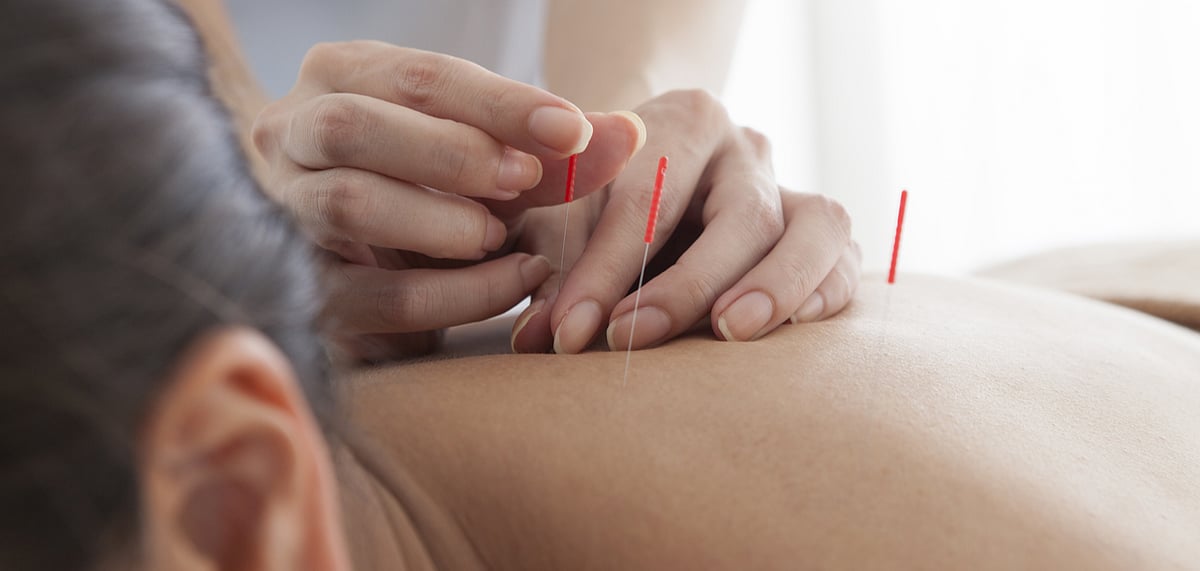This Wellness Centre is Hosting Renowned Acupuncture Specialist Linda Carter