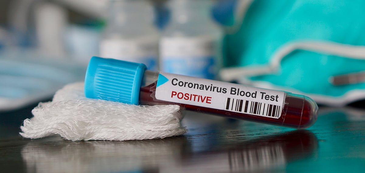 Coronavirus cases have been confirmed in 20 countries so far