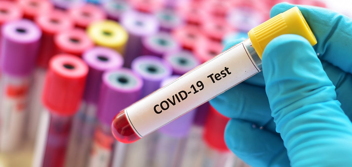 There have been several incidents where passengers have produced fake test reports 