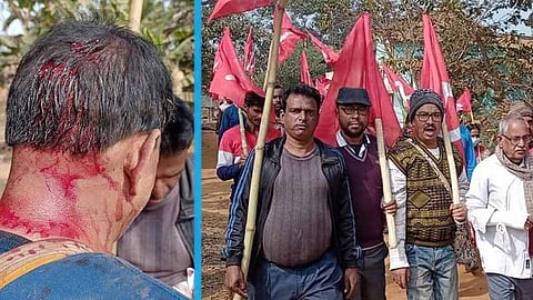 বাঁকুড়ায় বাম মিছিলে আক্রান্ত এক কর্মী