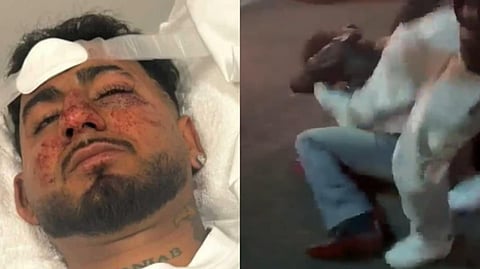 আক্রান্ত যুবক (বামদিকে) এবং যুবককে হেনস্থা (ডানদিকে)