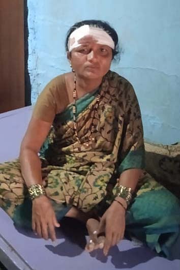 ಮಹಿಳೆಯನ್ನು ಕಚ್ಚಿ ಗಾಯಗೊಳಿಸಿದ ಮುಸಿಯಾ