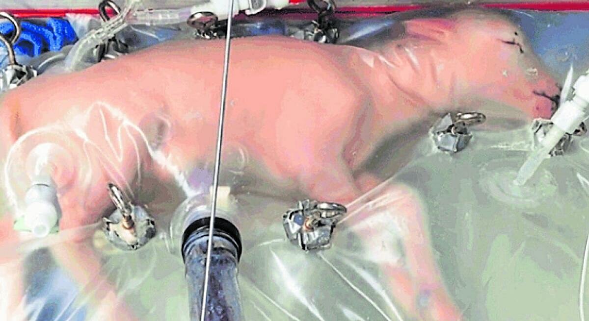 ಗರ್ಭಾಶಯಕ್ಕೇ ಕುತ್ತು!