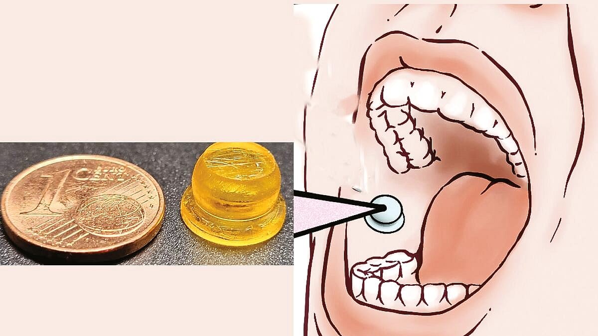 ವಿಜ್ಞಾನ: ಬಾಯಿಯೊಳಗೆ ಆಕ್ಟೋಪಸ್‌ ಗುಳಿಗೆ! ಔಷಧವನ್ನು ನೀಡುವ ವಿಶಿಷ್ಟ ಸಾಧನ