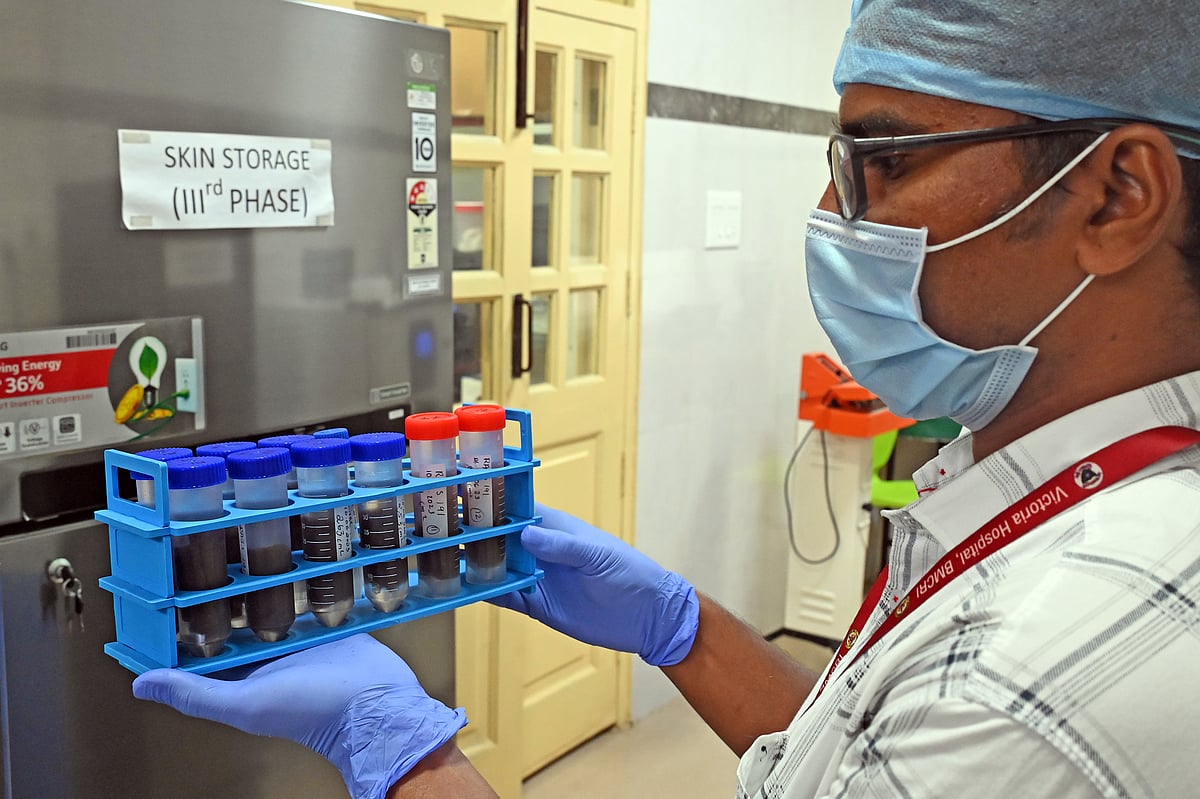 ಚರ್ಮ ಬ್ಯಾಂಕ್: ಸೀಮಿತ ಚರ್ಮ ದಾಸ್ತಾನು, ಹೊರ ರಾಜ್ಯಗಳಿಂದಲೂ ಬೇಡಿಕೆ