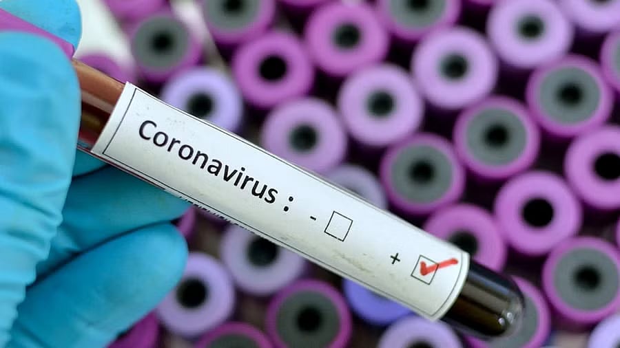 ದೇಶದಲ್ಲಿ 628 ಹೊಸ ಕೋವಿಡ್‌ ಕೇಸ್‌ ಪತ್ತೆ: 4,054ಕ್ಕೇರಿದ ಸಕ್ರಿಯ ಪ್ರಕರಣ