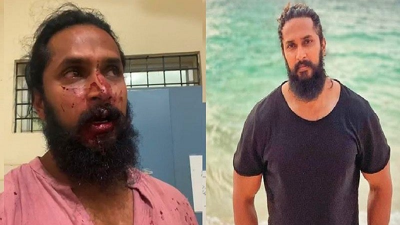 ನಟ ಚೇತನ್ ಚಂದ್ರ ಮೇಲೆ ಹಲ್ಲೆ