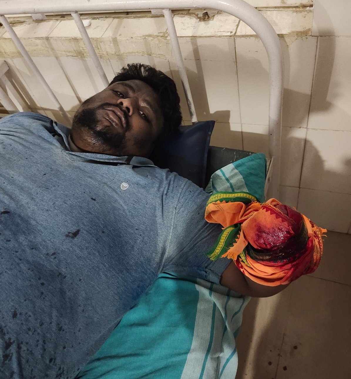 ಕನಕಪುರ: ಉಪಮುಖ್ಯಮಂತ್ರಿ ಕ್ಷೇತ್ರದಲ್ಲಿ ದಲಿತ ಯುವಕನ ಕೈ ಕಡಿದರು