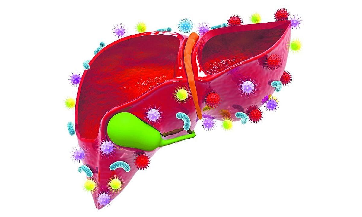 ಆರೋಗ್ಯ: ಫ್ಯಾಟಿ ಲಿವರ್‌ ಎಚ್ಚರ ತಪ್ಪದಿರಿ