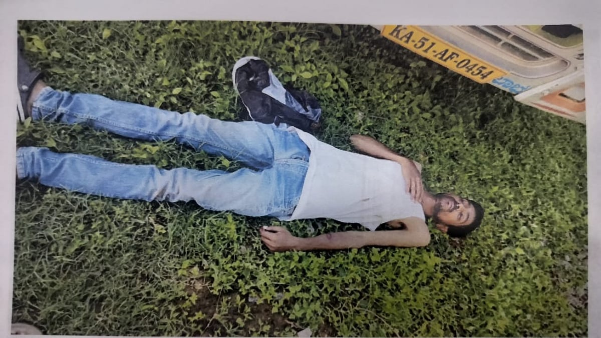 ಕ್ರೌರ್ಯಕಾಂಡ:ರೇಣುಕಸ್ವಾಮಿ ಮರ್ಮಾಂಗಕ್ಕೆ ನಟ ದರ್ಶನ್ ಒದ್ದಿದ್ದು ತನಿಖೆಯಲ್ಲಿ ದೃಢ