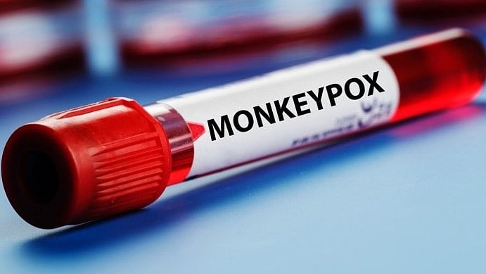 ಮಂಕಿಪಾಕ್ಸ್ ಒಬ್ಬರಿಗೆ ದೃಢ, ಸಾರ್ವಜನಿಕರಿಗೆ ತಕ್ಷಣದ ಅಪಾಯವಿಲ್ಲ: ಕೇಂದ್ರ