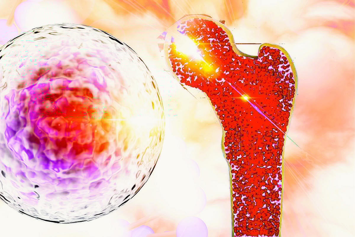 ಮೂಳೆ ಸೋಂಕಿಗೆ ಒಳಗಾಗಿದ್ರೆ ಪರಿಹಾರವೇನು ಗೊತ್ತಾ?