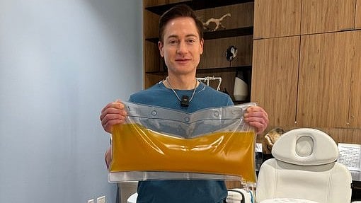 ತನ್ನ ಪ್ಲಾಸ್ಮಾ ನೀಡಿ ತಂದೆಯ ವಯಸ್ಸನ್ನು 25 ವರ್ಷ ತಗ್ಗಿಸಿದ ಆಧುನಿಕ ಪುರು