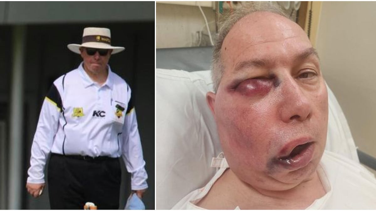 ಆಸ್ಟ್ರೇಲಿಯಾ | ಚೆಂಡು ಬಡಿದು ಅಂಪೈರ್‌ ಮುಖಕ್ಕೆ ತೀವ್ರ ಗಾಯ