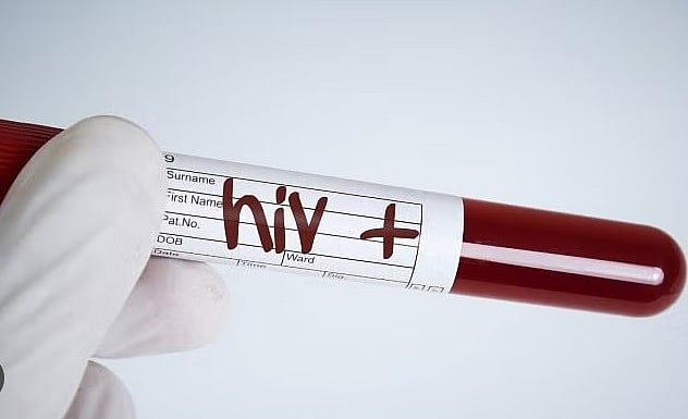 ಬೀದರ್‌: ಏರುಮುಖದತ್ತ ಎಚ್‌ಐವಿ ಪೀಡಿತರ ಸಂಖ್ಯೆ