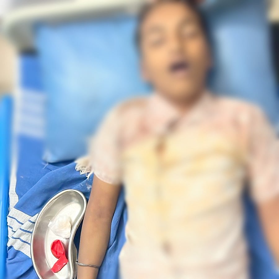 ಗಂಟಲಲ್ಲಿ ಬಲೂನ್ ಸಿಲುಕಿ 13 ವರ್ಷದ ಬಾಲಕ ಸಾವು! ಹಳಿಯಾಳದ ಜೋಗನಕೊಪ್ಪದಲ್ಲಿ ಘಟನೆ