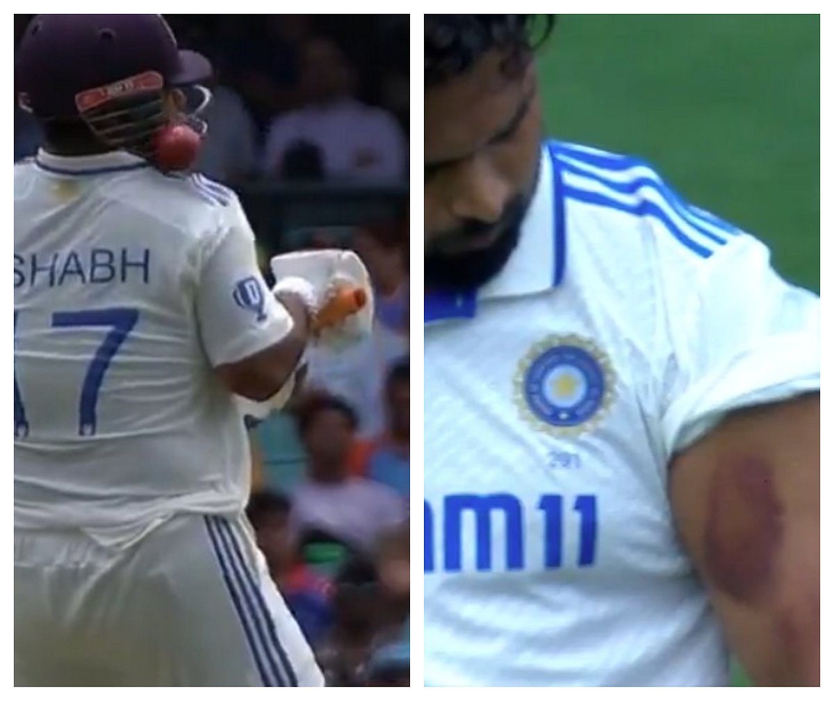 ಆಸೀಸ್ ಬೌಲರ್‌ಗಳ ಮಾರಕ ದಾಳಿ; ರಿಷಭ್‌ಗೆ ಸತತ ಏಟು; ಕಡೆಗೂ ಔಟ್