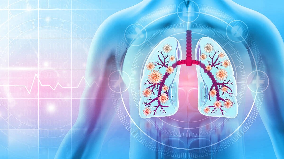 HMPV | ಉಸಿರಾಟದ ಸೋಂಕಿನ ಬಗ್ಗೆ ಜನರಲ್ಲಿ ಜಾಗೃತಿ ಮೂಡಿಸಿ: ರಾಜ್ಯಗಳಿಗೆ ಕೇಂದ್ರ