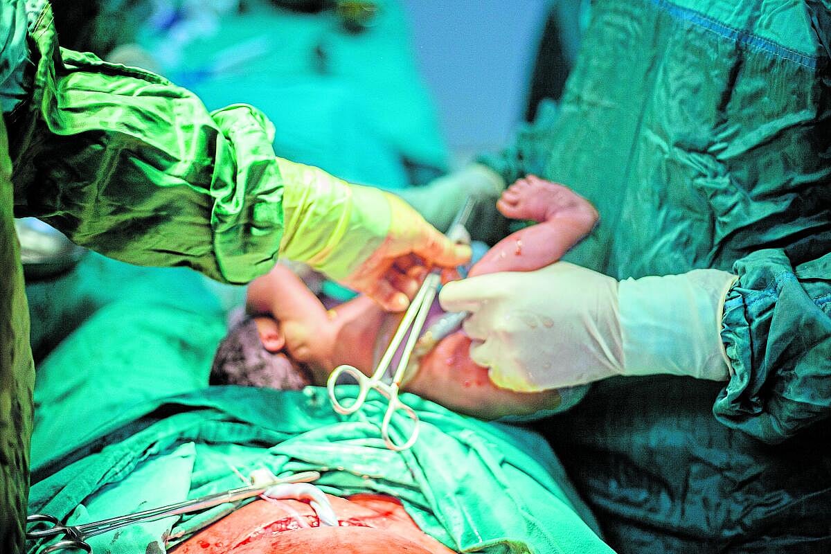 ಆಳ-ಅಗಲ | ಸಿಸೇರಿಯನ್‌: ಹೆಚ್ಚಳ ತಂದ ಕಳವಳ 