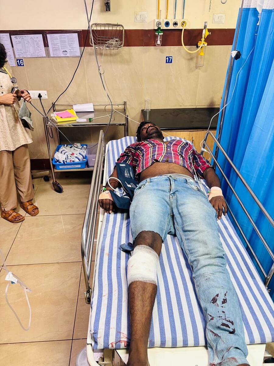 ಕೋಟೆಕಾರು ಬ್ಯಾಂಕ್‌ ದರೋಡೆ ಪ್ರಕರಣ: ಆರೋಪಿ ಕಾಲಿಗೆ ಗುಂಡೇಟು