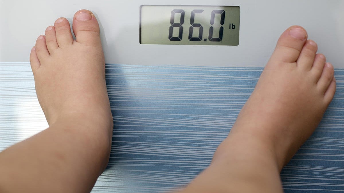 ಬಾಲ್ಯದಲ್ಲೇ ಸ್ಥೂಲಕಾಯ; ದಕ್ಷಿಣ ಏಷ್ಯಾ ಮಕ್ಕಳನ್ನು ಕಾಡುತ್ತಿರುವ ಬೊಜ್ಜು: ಅಧ್ಯಯನ