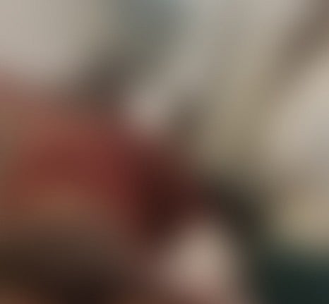 ರಾಯಚೂರು: ಕುರಿಗಾಯಿ ಮೇಲೆ ಕಾಡುಹಂದಿ ದಾಳಿ