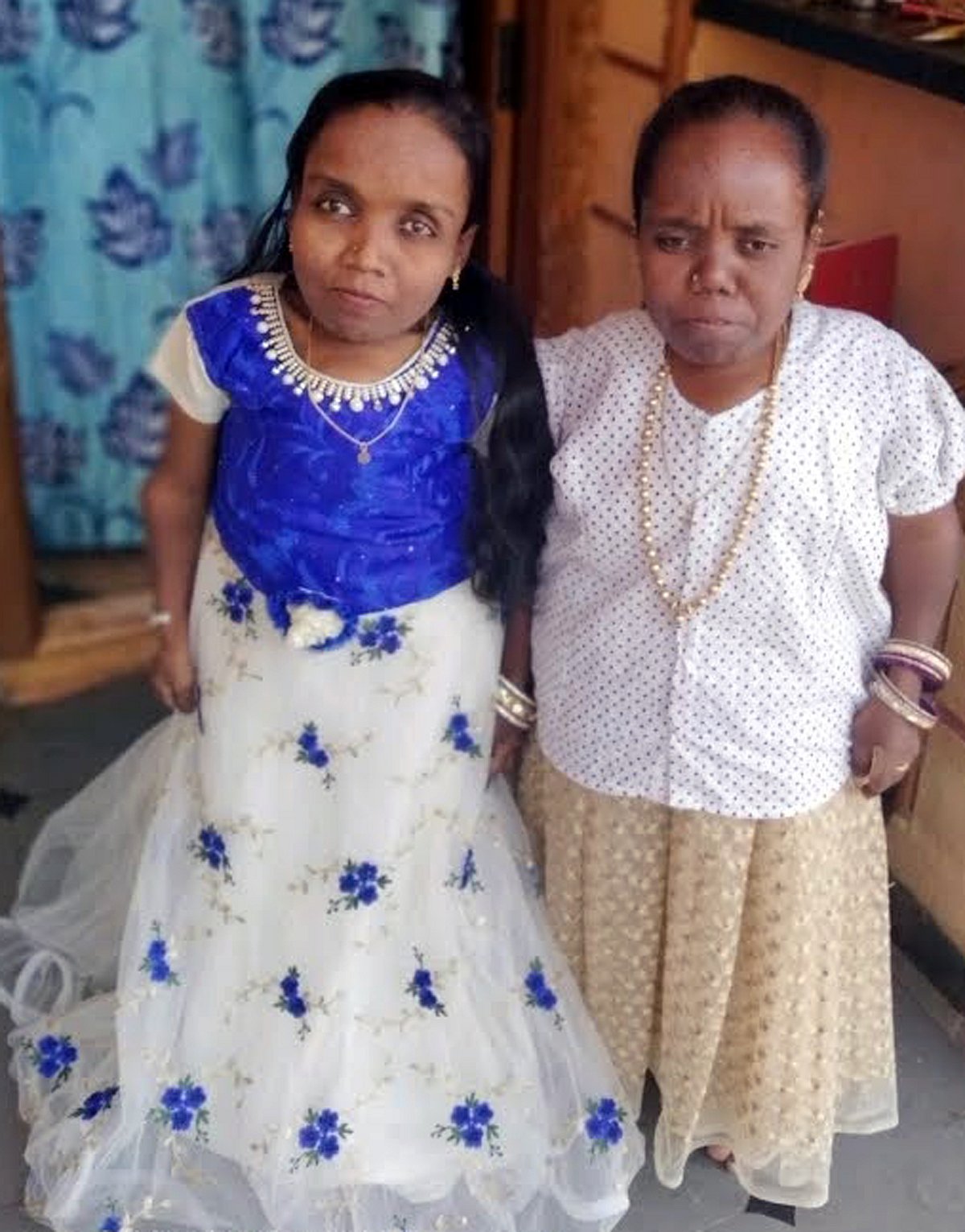 ಬದುಕು ಕಸಿದುಕೊಂಡ ಮಲಪ್ರಭಾ ಪ್ರವಾಹ: ಕುಬ್ಜರ ಕುಟುಂಬಕ್ಕೆ ಬೇಕಿದೆ ‘ನೆರಳು’