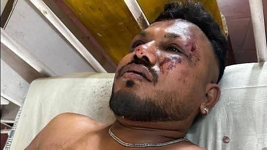 Ahmedabad Plane Crash: ವಿಶ್ವಾಸ್ ಪವಾಡಸದೃಶವಾಗಿ ಪಾರಾಗಿದ್ದು ಹೇಗೆ?