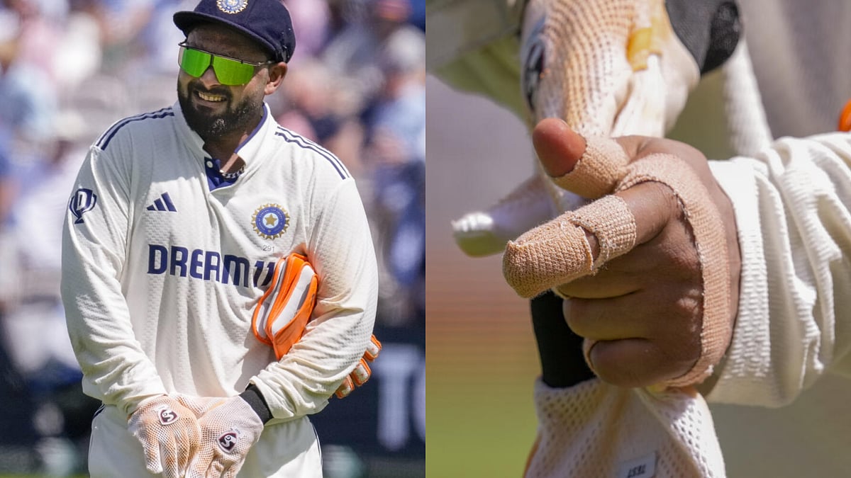 Lords Test | ರಿಷಭ್ ಪಂತ್‌ಗೆ ಗಾಯ; ವೈದ್ಯಕೀಯ ನಿಗಾ ವಹಿಸುತ್ತಿರುವ ಬಿಸಿಸಿಐ 