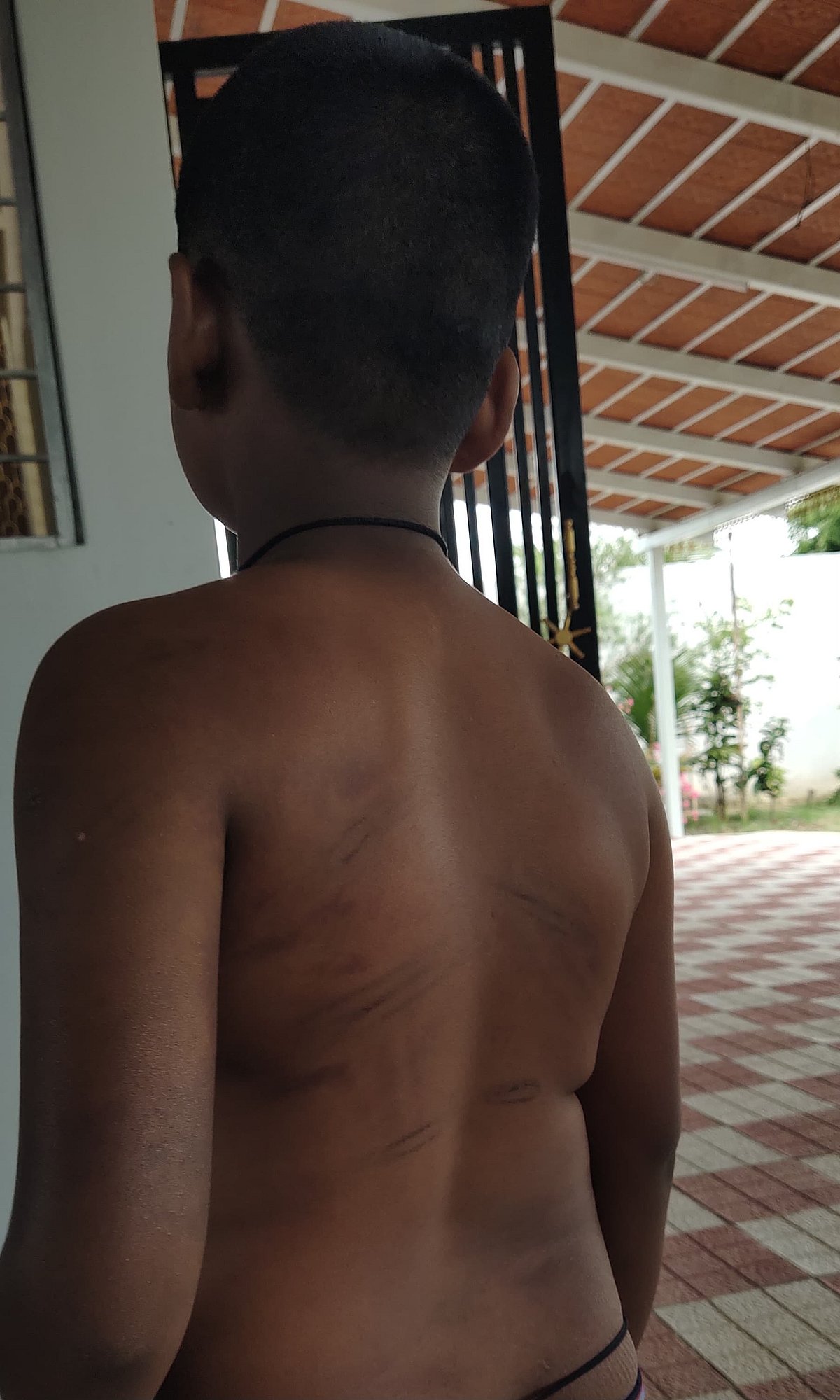 ಮುಳಬಾಗಿಲು: ಬಾಸುಂಡೆ ಬರುವಂತೆ ವಿದ್ಯಾರ್ಥಿ ಥಳಿಸಿದ ವಾರ್ಡನ್‌