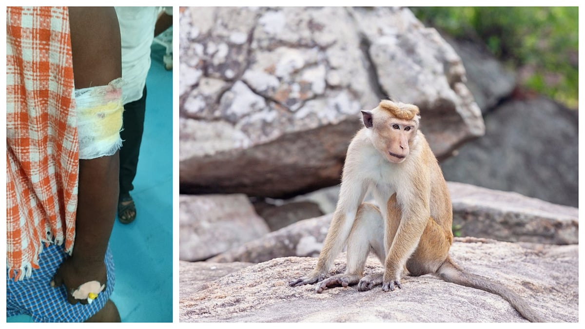 ಮಂಗ ದಾಳಿ: ಹಲವರಿಗೆ ಗಂಭೀರ ಗಾಯ