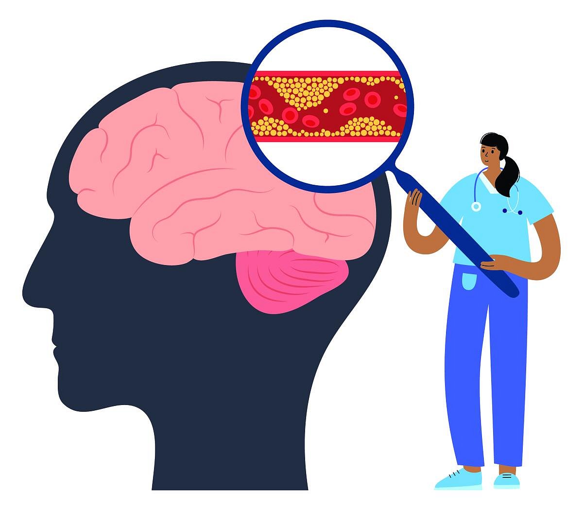 ಕೋಯಿಕ್ಕೋಡ್‌  | ಮಿದುಳು ಸೋಂಕು: ಬಾಲಕಿ ಸಾವು
