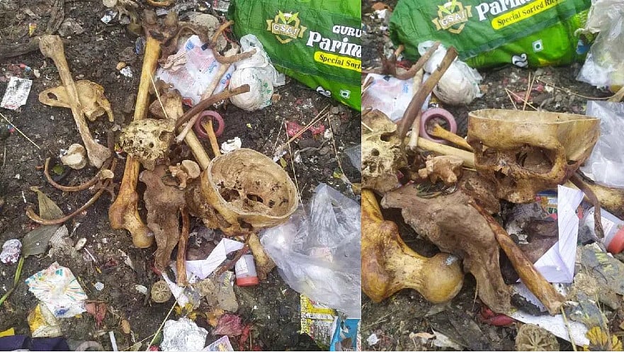 ಬೆಂಗಳೂರು: ಆತಂಕ ತಂದೊಡ್ಡಿದ ಬುರುಡೆ, ಮೂಳೆ 